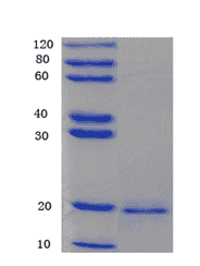 Human monocyte chemoattractant protein- 1, MCP1 Protein